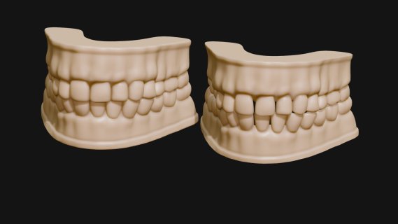 牙齿 模具 模型 医用物件