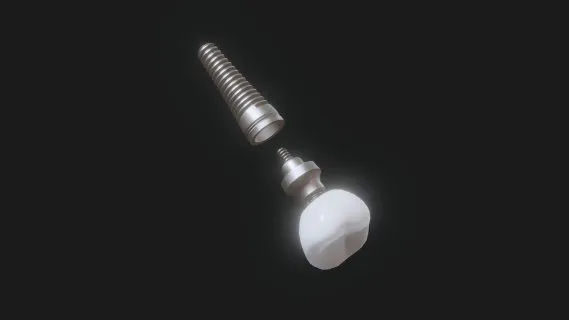 种牙 手术  种牙模具 模型 医用模型