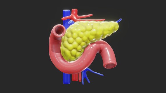 胰腺 模具 模型 医学模型